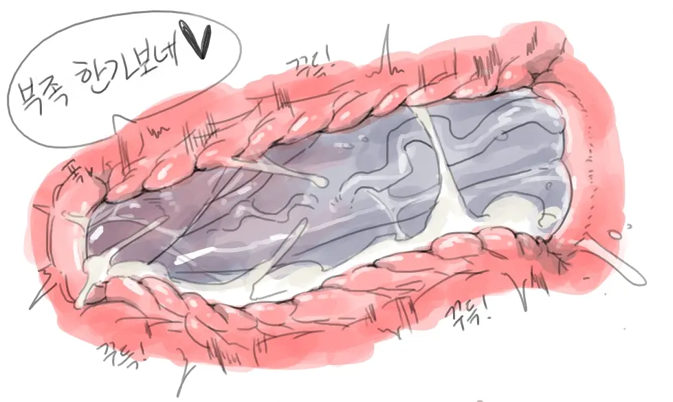 넷캔